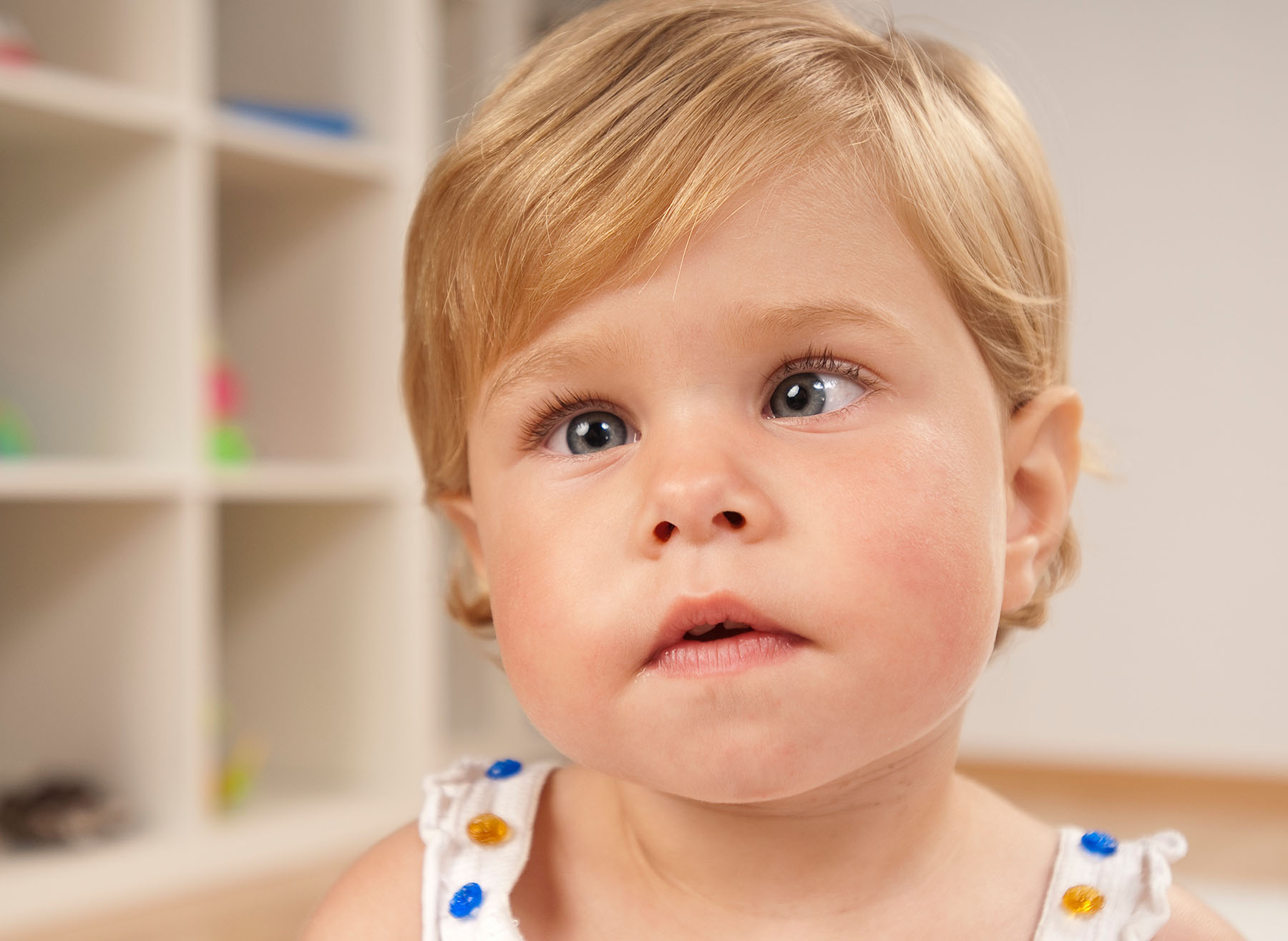 baby with wandering eye