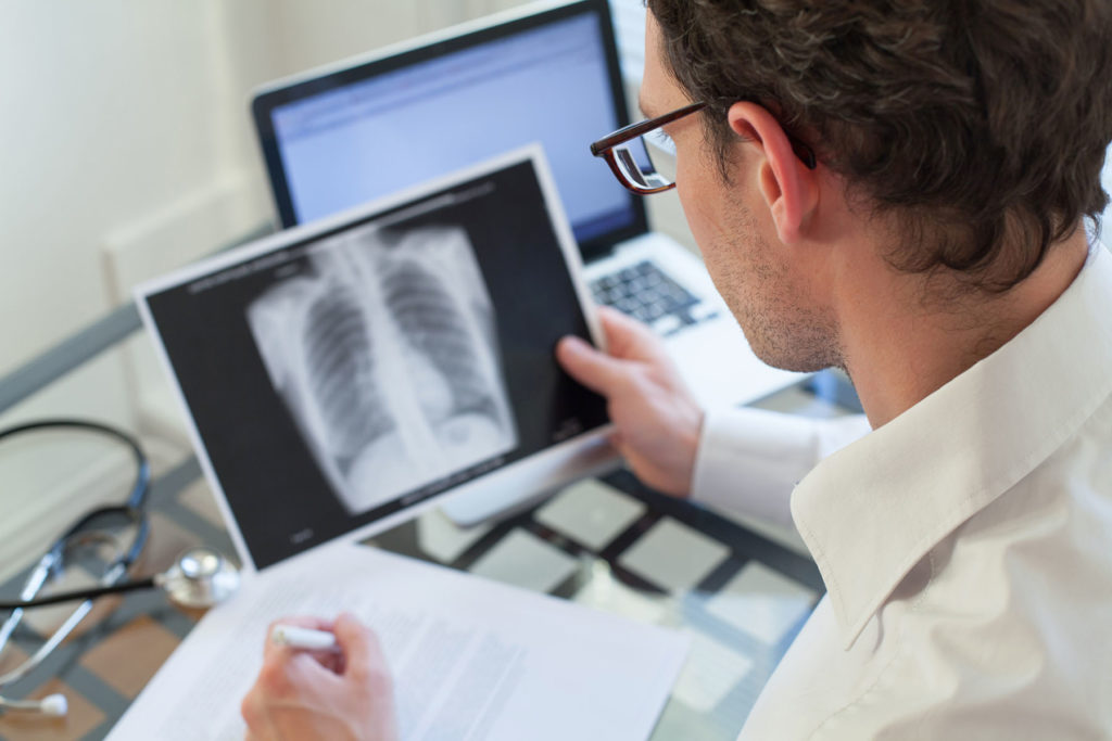 Doctor looking at xRay of lungs