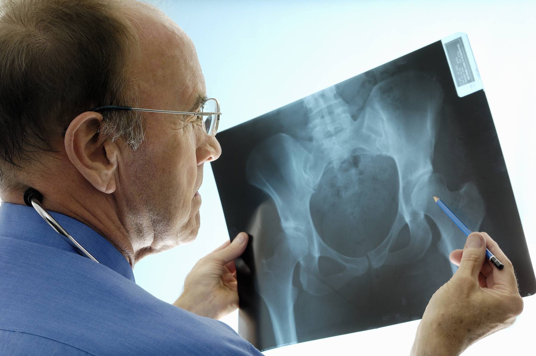 Ortho doctor looks at hip X-Ray