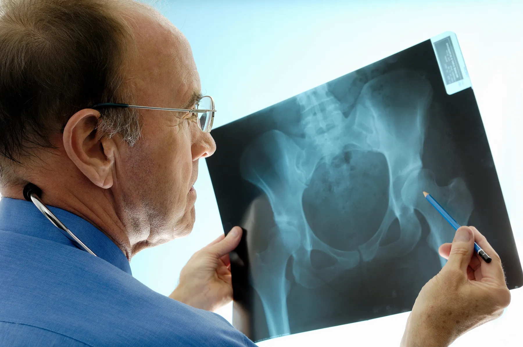 A medical professional wearing glasses and a stethoscope examines a hip and pelvic X-ray, pointing with a pencil.