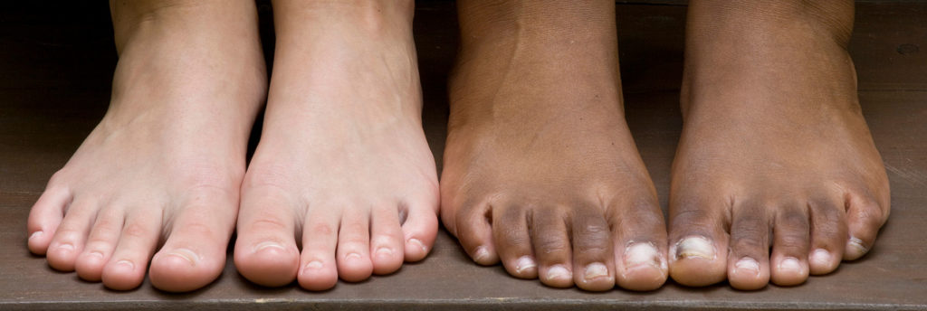 Close up of two pairs of feet