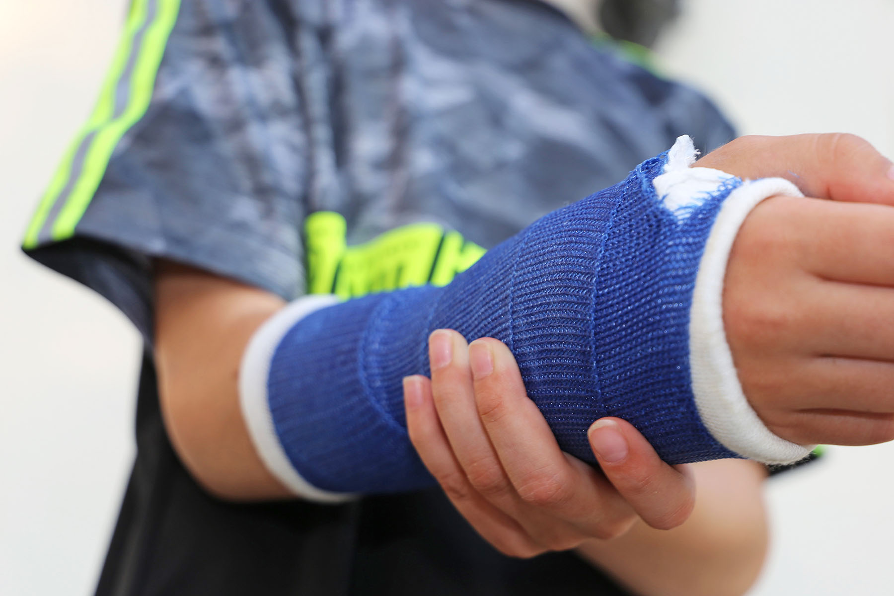 Boy with Arm in Cast after an injury
