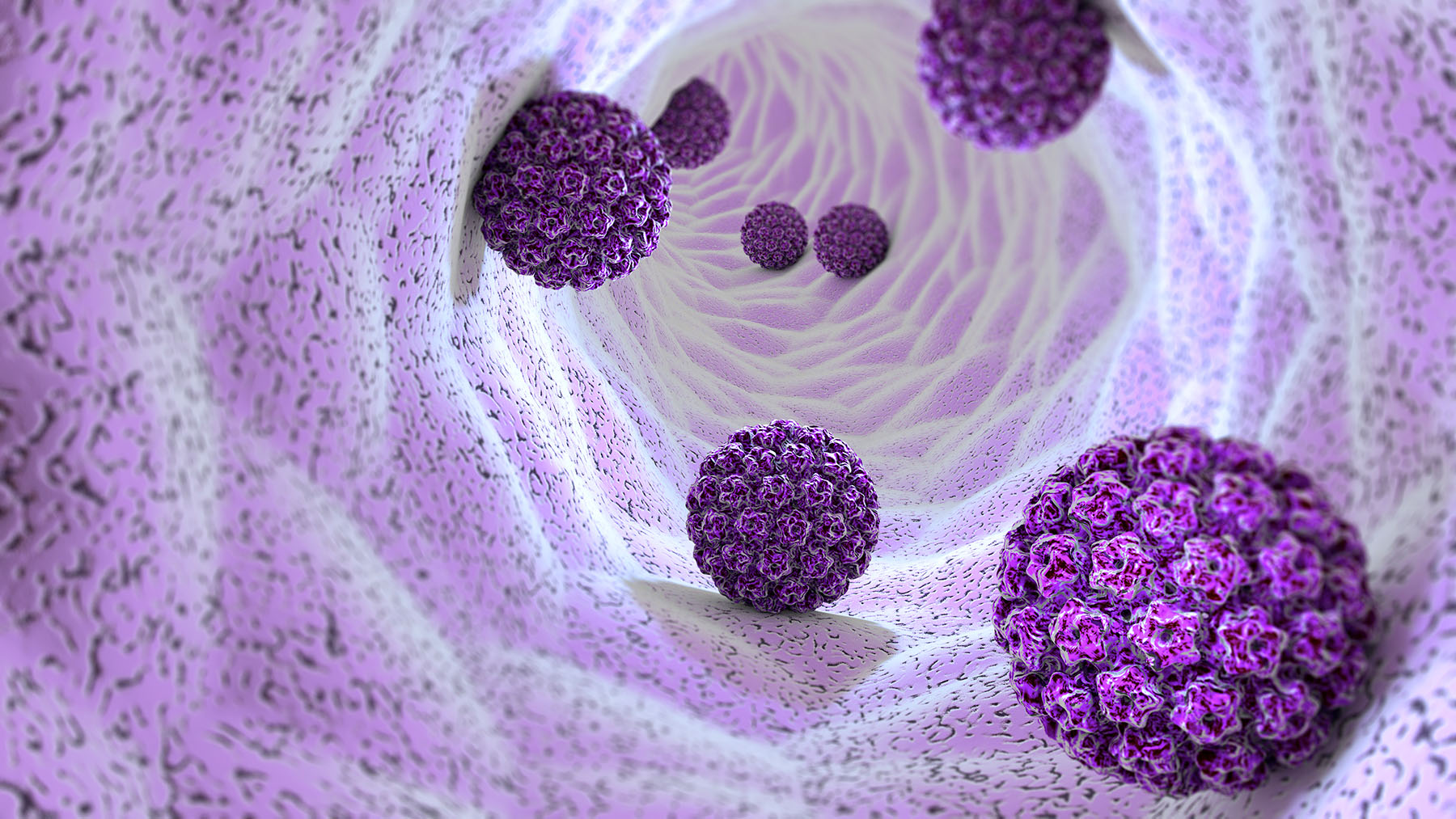 Graphic of HPV growths