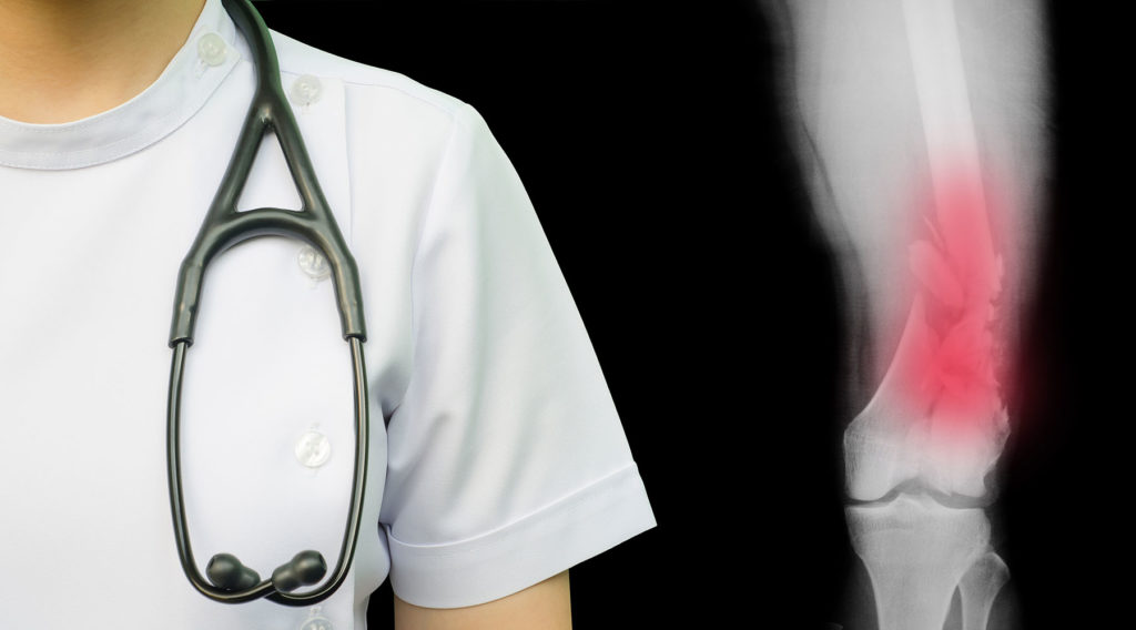 Orthopedic doctor stands next to knee Xray