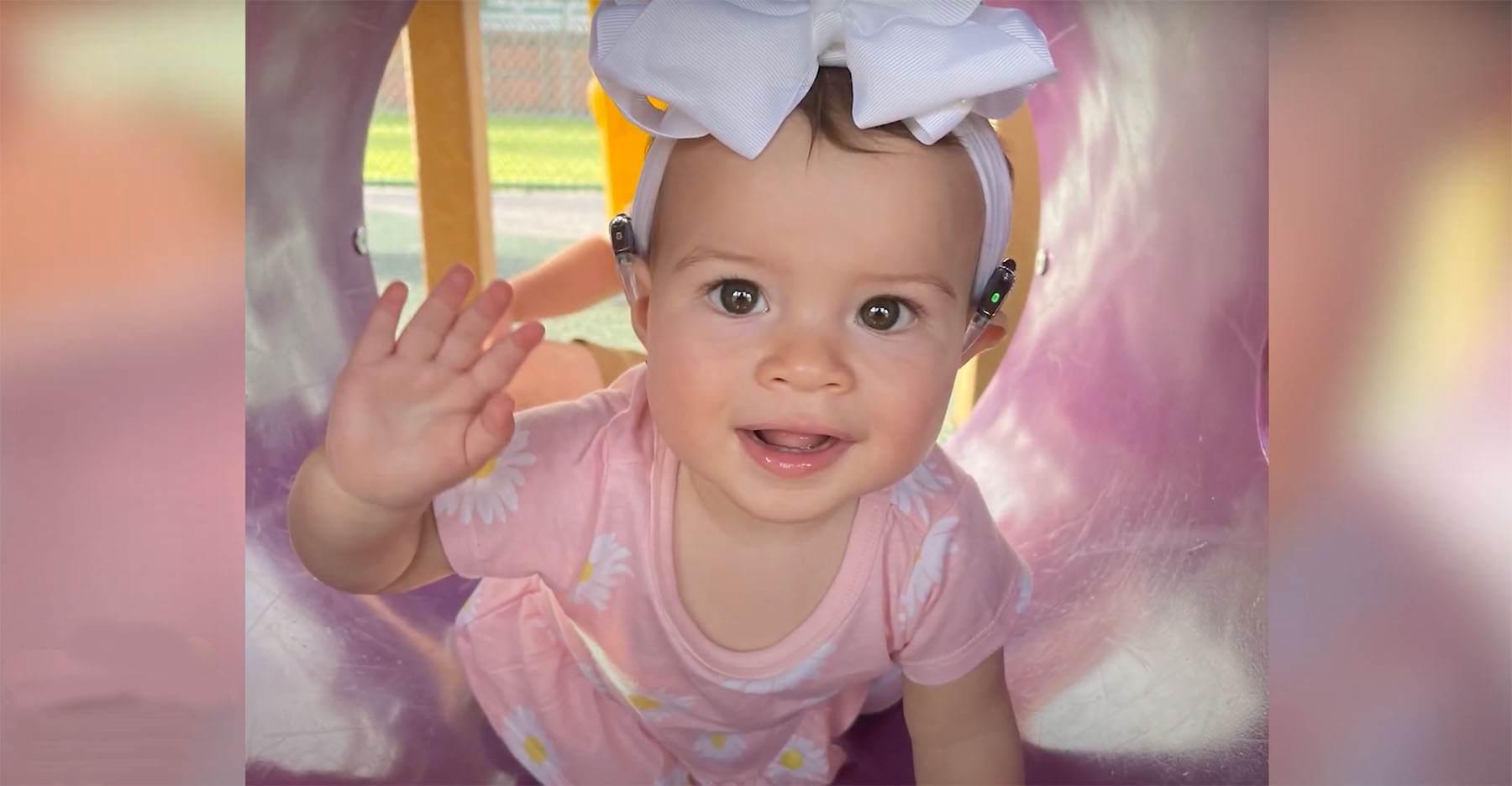 Adorable baby with cochlear implants playing