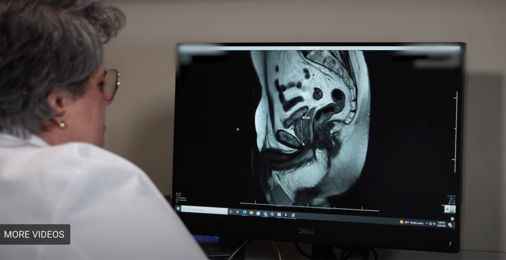 doctor looks at prostate Xray