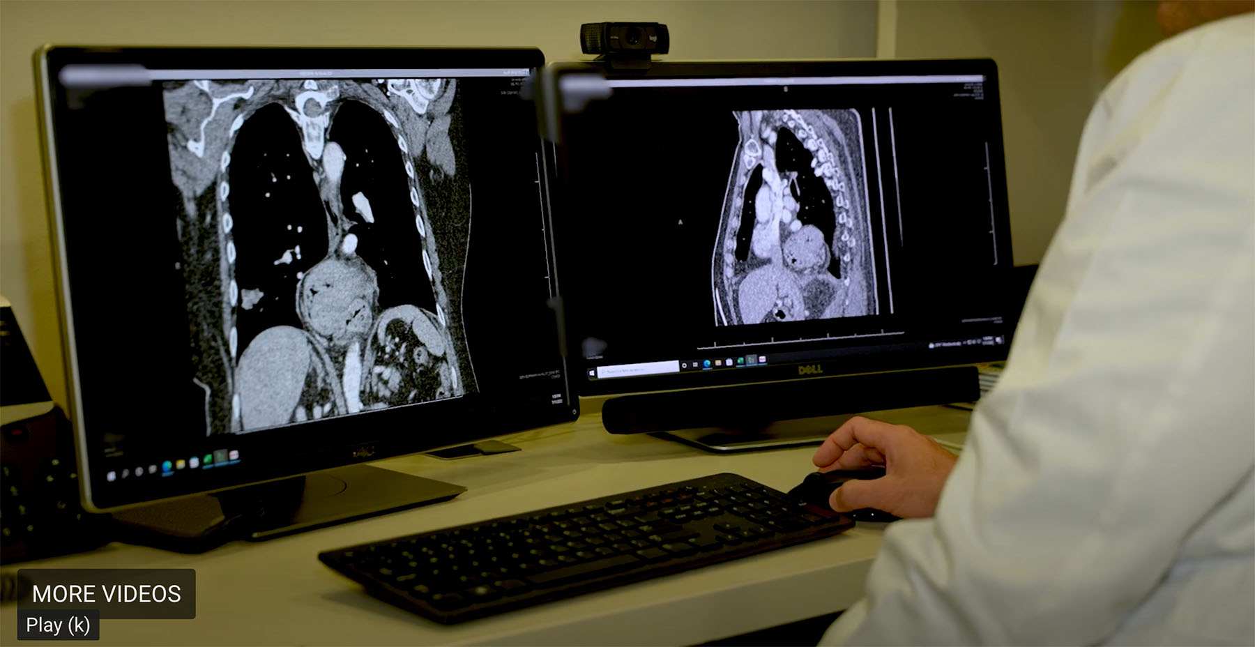 Doctor looks at two Xray screens