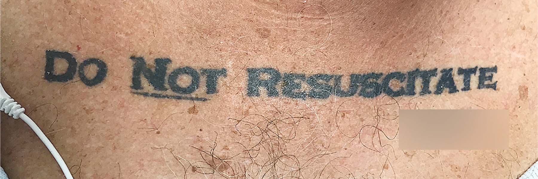 Photo of a tattoo that reads "DO NOT RESUSCITATE" on the hairy chest of a patient
