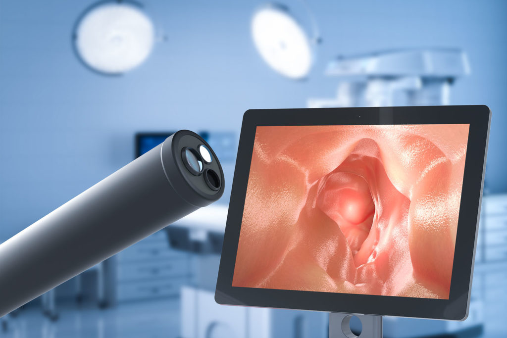 Rendering of a colonoscopy scope and the monitor