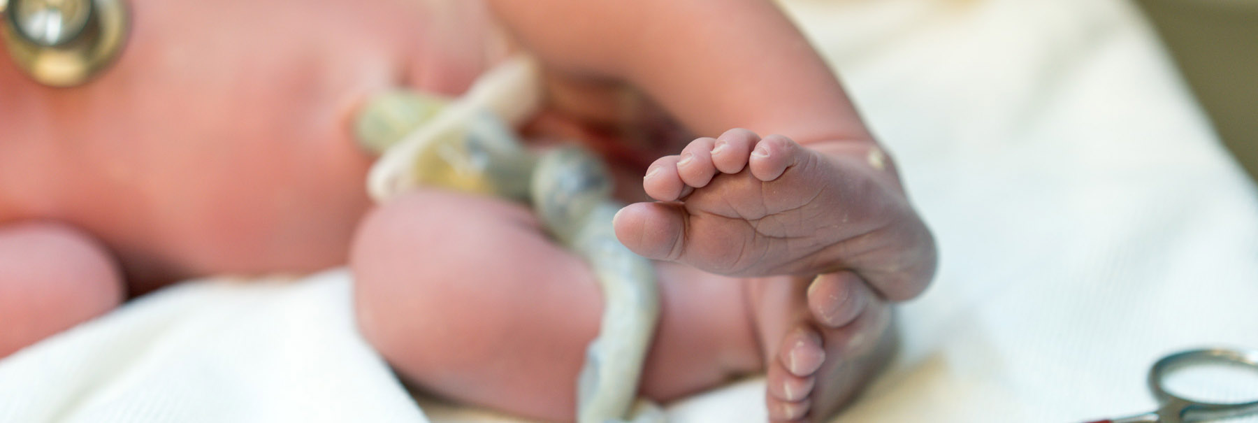 Close up of a newborn baby's feet and umbilical cord