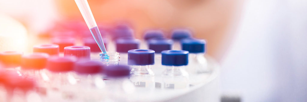 Tray full of pharmaceutical vials with a dropper filling one of them