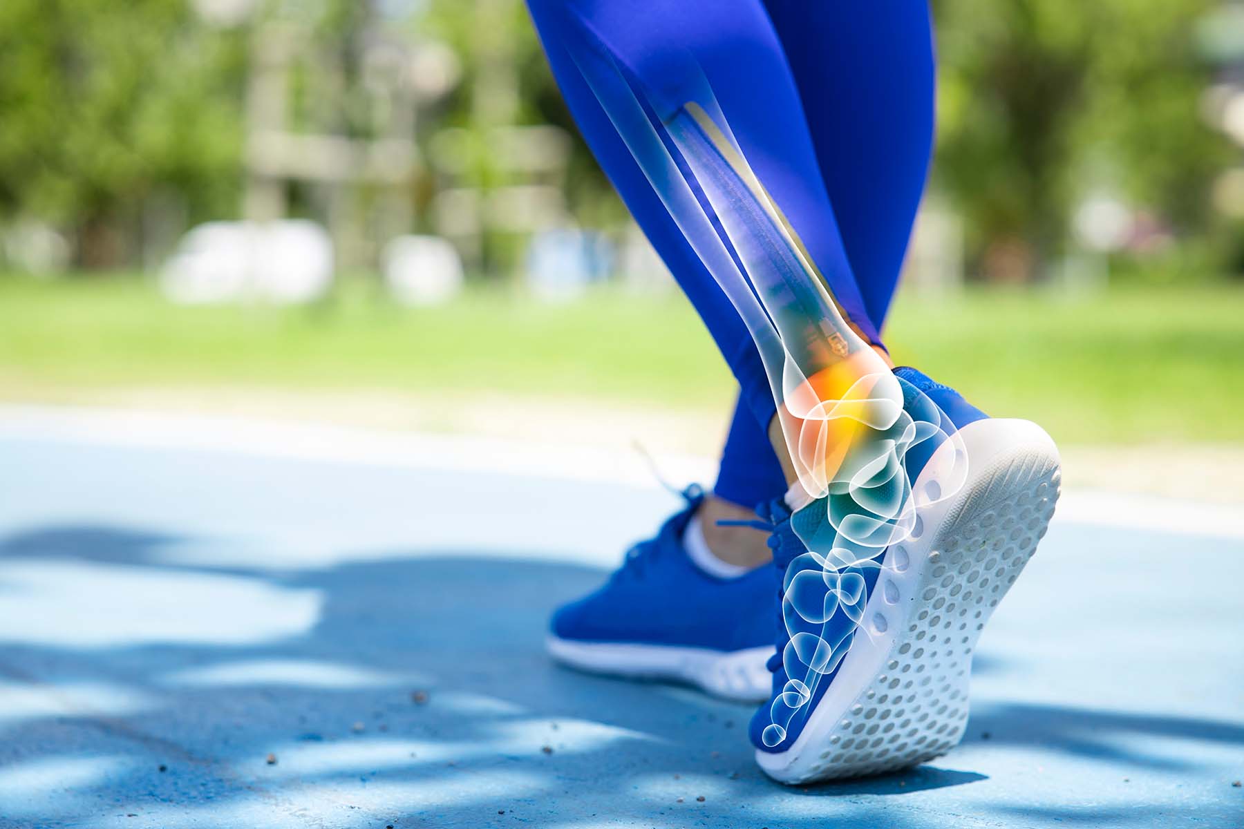 Close up of runner's legs in blue leggings with a graphic showing ankle injury.