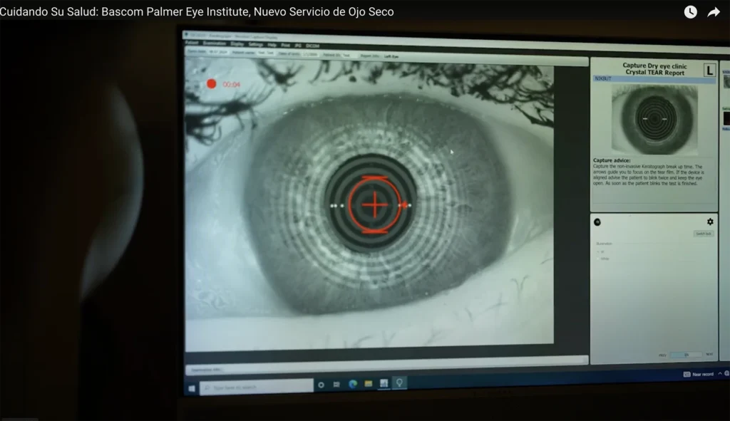 X-ray of eye