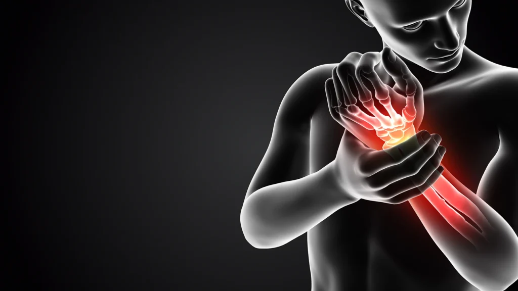 Illustration showing pain in the wrist for a story on post-traumatic arthristis