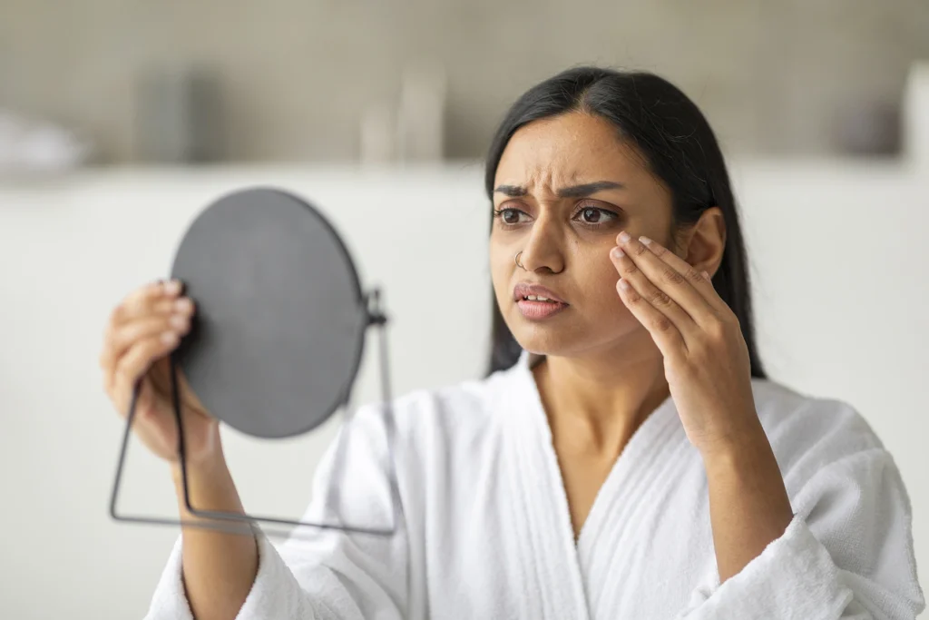 Woman inspecting her sunken eye symptoms. Stock photo to represent concerns over Ozempic face.