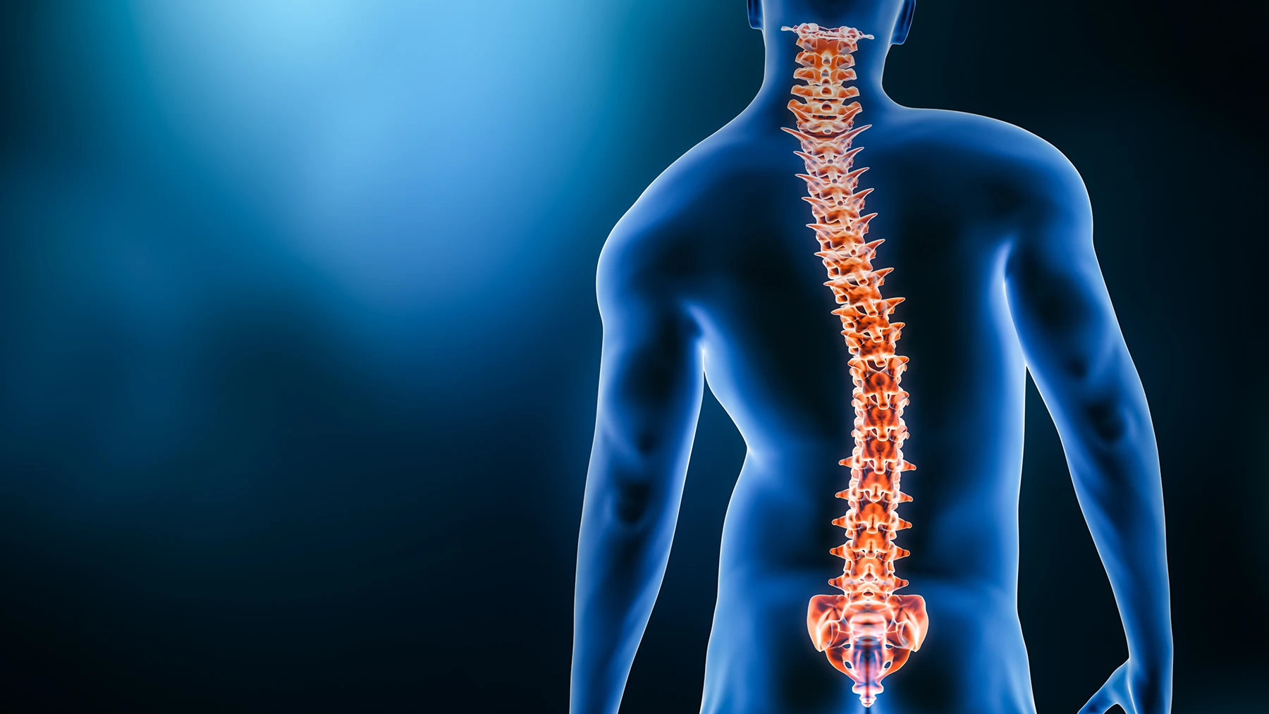 Graphic show the curvature of the spine caused by scoliosis in adults.