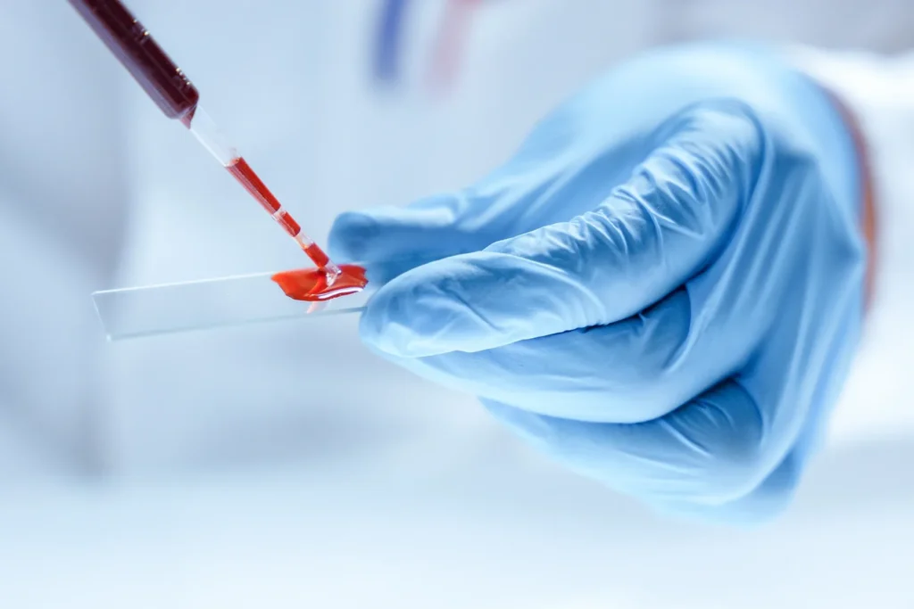 lab technician performing a liquid biopsy