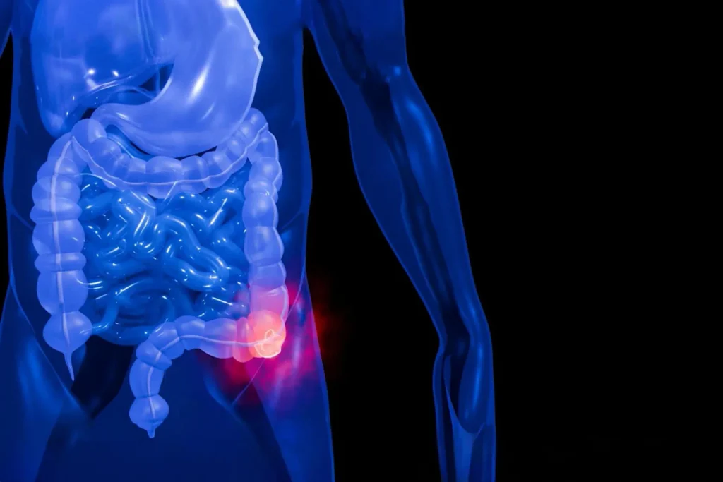 Colonoscopy Prevents and Detects Colorectal Cancer | Sylvester Cancer Center